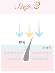 脱毛の流れステップ2