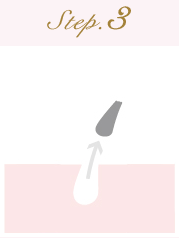 脱毛の流れステップ3
