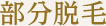 所沢の脱毛サロンp-nap(ピーナップ)の部分脱毛